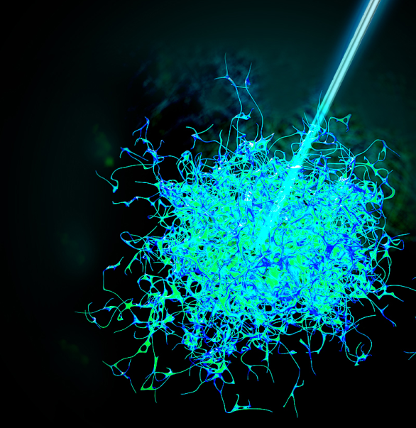 今天,我们把肿瘤的内部「融穿」了